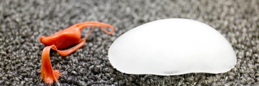 chewing gum from carpet